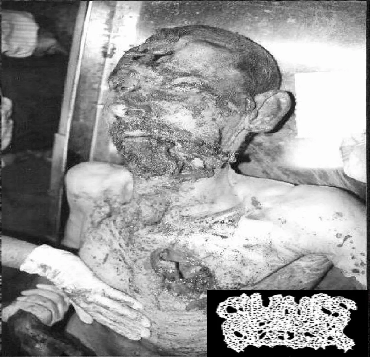 Clumps of Flesh - Corpse Mutilation Album Cover Artwork