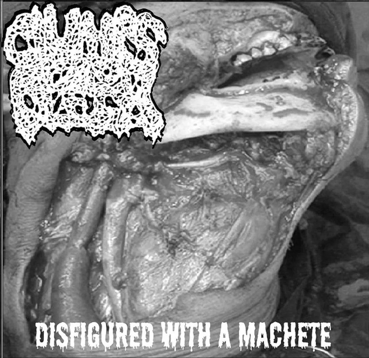 Clumps of Flesh - Disfigured with a Machete Album Cover Artwork