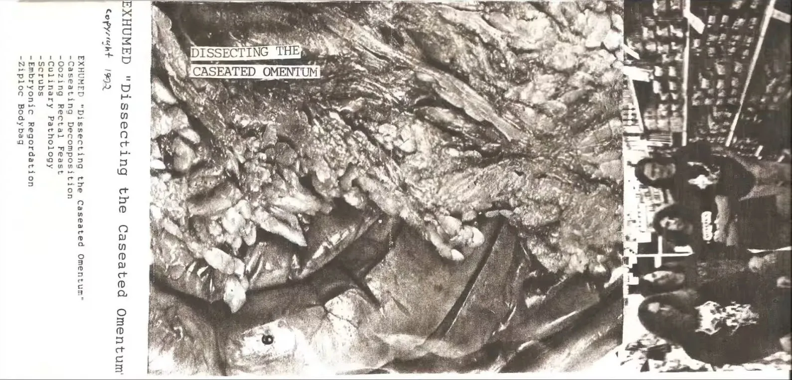Dissecting the Caseated Omentum
