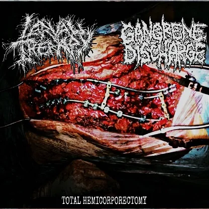 Gangrene Discharge - Total Hemicorporectomy Album Cover Artwork