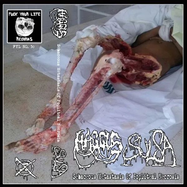 Haggus - Sebaceous Metastasis of Popliteal Necrosis Album Cover Artwork