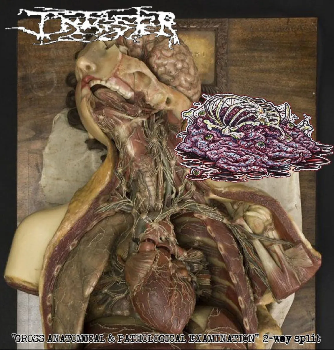 Infester - Gross Anatomical & Pathological Examination Album Cover Artwork