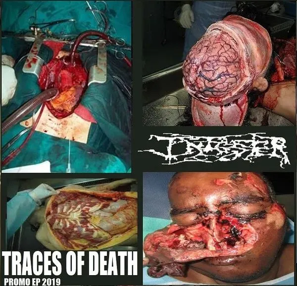 Infester - Traces of Death - Promo EP 2019 Album Cover
