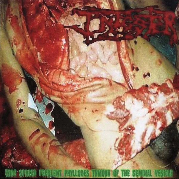 Infester - Wide Spread Feculent Phyllodes Tumour of the Seminal Vesicle Album Cover Artwork