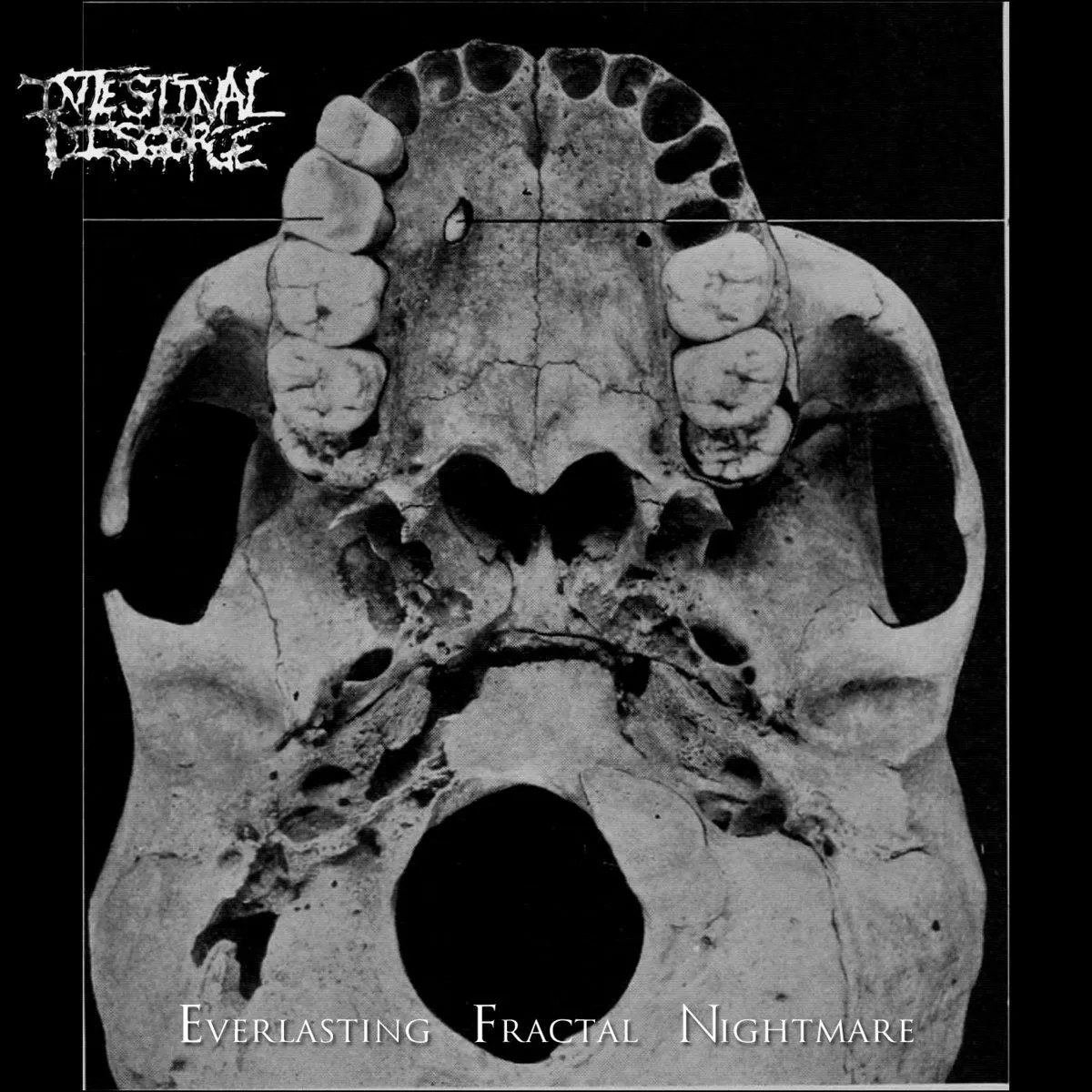 Intestinal Disgorge - Everlasting Fractal Nightmare Album Cover Artwork